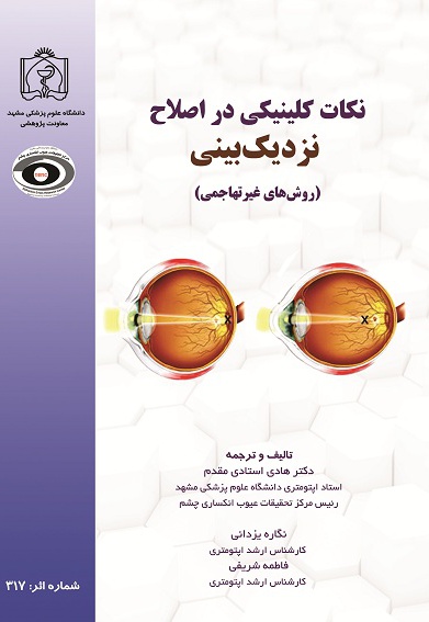 نکات کلینیکی در اصلاح نزدیک بینی